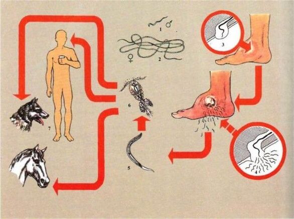 Dezvoltarea dracunculozei