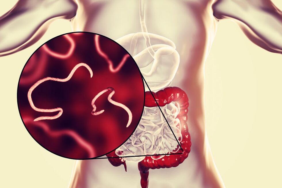 viermi în intestinele umane